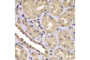 Immunohistochemistry of paraffin-embedded human kidney using BAG2 antibody (ABIN5975636) at dilution of 1/100 (40x lens). (BAG2 anticorps)