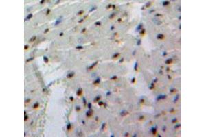 Used in DAB staining on fromalin fixed paraffin-embedded Heart tissue (EBF1 anticorps  (AA 179-451))
