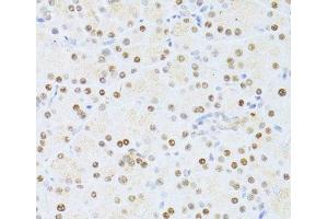 Immunohistochemistry of paraffin-embedded Rat pancreas using ETV1 Polyclonal Antibody at dilution of 1:100 (40x lens). (ETV1 anticorps)