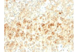 Formalin-fixed, paraffin-embedded human Adrenal Gland stained with Adipophilin Recombinant Rabbit Monoclonal Antibody (ADFP/2755R).