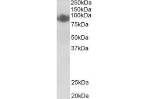 ABIN571072 (0. (PRDM1 anticorps  (Internal Region))
