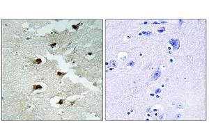 Immunohistochemistry analysis of paraffin-embedded human brain tissue using CDCA4 antibody. (CDCA4 anticorps  (Internal Region))