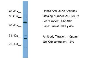 WB Suggested Anti-ULK3  Antibody Titration: 0. (ULK3 anticorps  (Middle Region))
