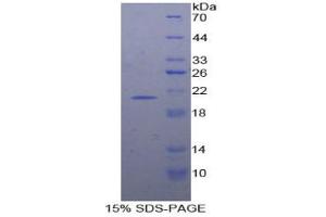 SDS-PAGE analysis of Human Interferon alpha 7 Protein.