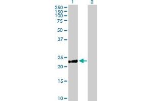 Western Blot analysis of DCAKD expression in transfected 293T cell line by DCAKD MaxPab polyclonal antibody. (DCAKD anticorps  (AA 1-231))