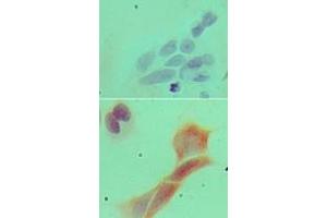 Image no. 3 for anti-Myeloid Differentiation Primary Response Gene (88) (MYD88) (AA 50-100) antibody (ABIN959910)