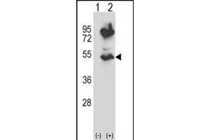 Western blot analysis of HTRA2 (arrow) using rabbit polyclonal HTRA2 Antibody (N-term) (ABIN657628 and ABIN2846624). (HTRA2 anticorps  (N-Term))