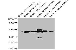 Western Blot Positive WB detected in: Mouse liver tissue, Mouse brain tissue, Mouse lung tissue, Mouse kidney tissue, Mouse spleen tissue, Mouse stomach tissue All lanes: ACTB antibody at 1:5000 Secondary Goat polyclonal to mouse IgG at 1/50000 dilution Predicted band size: 42 KDa Observed band size: 42 KDa Exposure time: 5 min (beta Actin anticorps  (AA 1-50))
