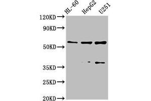 Western Blot Positive WB detected in: HL-60 whole cell lysate, HepG2 whole cell lysate, U251 whole cell lysate All lanes: ENTPD1 antibody at 2. (CD39 anticorps  (AA 316-474))