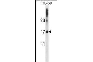 DNAL4 Antibody (N-term) (ABIN657490 and ABIN2846517) western blot analysis in HL-60 cell line lysates (35 μg/lane). (DNAL4 anticorps  (N-Term))