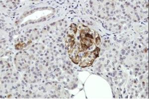 IHC-P Image Immunohistochemical analysis of paraffin-embedded Human pancreas tissue, using ANXA2, antibody at 1:100 dilution.