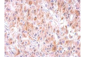 IHC-P Image Immunohistochemical analysis of paraffin-embedded U373 xenograft, using GSTM1, antibody at 1:500 dilution.