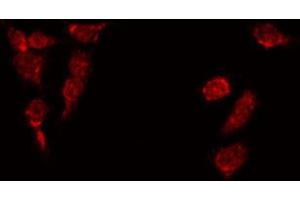 ABIN6269272 staining HepG2 by IF/ICC.