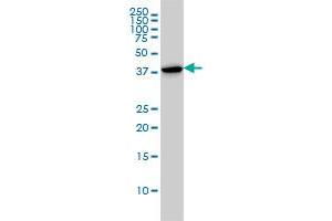 CAPG monoclonal antibody (M01), clone 1F1 Western Blot analysis of CAPG expression in HL-60 .