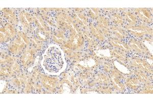 Detection of ADRP in Human Kidney Tissue using Polyclonal Antibody to Adipose Differentiation Related Protein (ADRP)