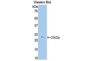 Western Blotting (WB) image for anti-phosphorylase, Glycogen, Liver (PYGL) (AA 370-538) antibody (ABIN1860383)
