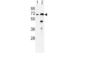 Western Blotting (WB) image for anti-Enoyl-CoA, Hydratase/3-Hydroxyacyl CoA Dehydrogenase (EHHADH) antibody (ABIN3003844)