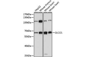 Western blot analysis of extracts of various cell lines, using GLCCI1 antibody (ABIN7267395) at 1000 dilution. (GLCCI1 anticorps  (AA 120-230))