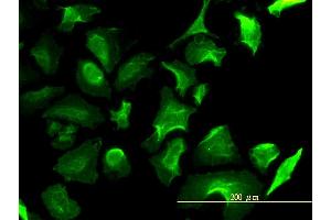 Immunofluorescence of monoclonal antibody to LDHB on HeLa cell.