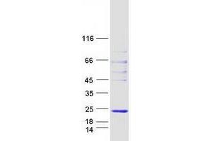 Validation with Western Blot