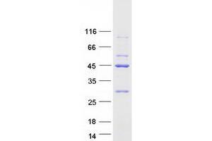 Validation with Western Blot