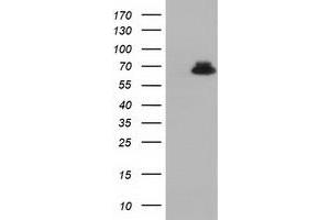 Western Blotting (WB) image for anti-Epoxide Hydrolase 2, Cytoplasmic (EPHX2) antibody (ABIN1500855) (EPHX2 anticorps)