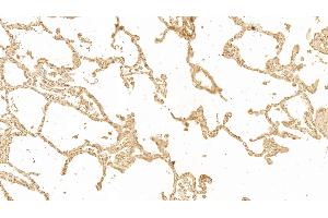Detection of GAL3 in Human Lung Tissue using Monoclonal Antibody to Galectin 3 (GAL3)