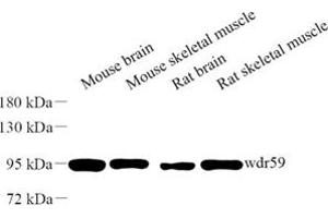 Western blot analysis of wdr59 (ABIN7076219) at dilution of 1: 500 (WDR59 anticorps)
