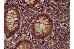 IHC image of ABIN7147311 diluted at 1:400 and staining in paraffin-embedded human appendix tissue performed on a Leica BondTM system. (CDCA7L anticorps  (AA 14-167))
