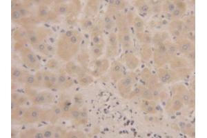DAB staining on IHC-P; Samples: Human Liver Tissue (MSMB anticorps  (AA 19-114))