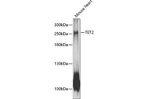 Western blot analysis of extracts of mouse heart, using TET2 antibody (ABIN6133018, ABIN6149016, ABIN6149018 and ABIN6216528) at 1:1000 dilution. (TET2 anticorps  (AA 1833-2002))