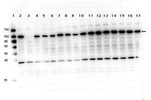Western Blot of Rabbit anti-PARP1 multi lysate Western Blot of Rabbit anti-PARP1 antibody.