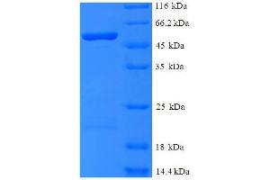 PLY1 (AA 22-374) protein (His-SUMO Tag)