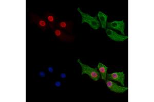 ABIN7094394 and ABIN7098441 staining HepG2 cells by IF/ICC.
