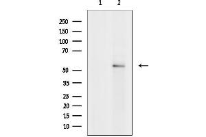 anti-gamma-aminobutyric Acid (GABA) Receptor, rho 2 (GABRR2) (Internal Region) antibody