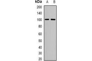 Western blot analysis of Neutral Ceramidase expression in mouse kidney (A), mouse heart (B) whole cell lysates. (ASAH2 anticorps)