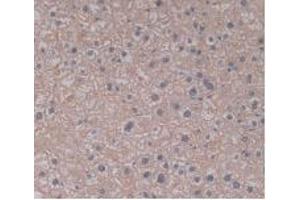 IHC-P analysis of Human Liver Tissue, with DAB staining. (TLR5 anticorps  (AA 693-858))