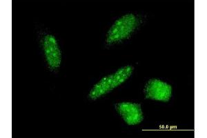 Immunofluorescence of monoclonal antibody to RNF24 on HeLa cell. (RNF24 anticorps  (AA 49-148))