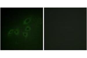 Immunofluorescence analysis of A549 cells, using JAK3 (Ab-785) Antibody.