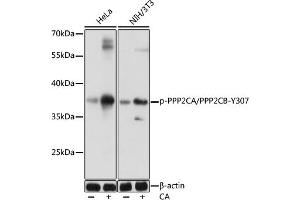 Western blot analysis of extracts of various cells, using Phospho-PPP2CA/PPP2CB-Y307 antibody (ABIN7269685) at 1:1000 dilution.