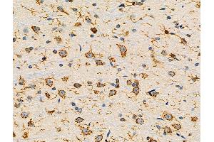 ABIN6265870 and ABIN6276708 at 1/100 staining Rat brain tissue by IHC-P.