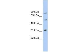 WB Suggested Anti-C6orf182 Antibody Titration: 0.