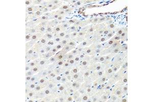 Immunohistochemistry of paraffin-embedded rat liver using PRPF19 antibody. (PRP19 anticorps  (AA 127-416))