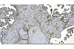 anti-DnaJ (Hsp40) Homolog, Subfamily C, Member 10 (DNAJC10) (AA 33-793) antibody