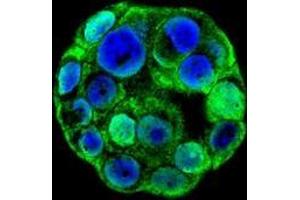 Confocal immunofluorescent analysis with WiDr cells using SP1 / TSFP1  Antibody (C-term), followed by Alexa Fluor 488-conjugated goat anti-rabbit lgG (green).