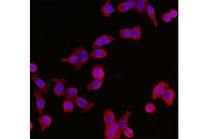 IF analysis of YWHAE using anti-YWHAE antibody (ABIN7599165). (YWHAE anticorps  (AA 1-255))