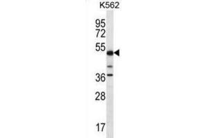 Western Blotting (WB) image for anti-Proline-serine-threonine Phosphatase Interacting Protein 1 (PSTPIP1) antibody (ABIN2996784) (PSTPIP1 anticorps)