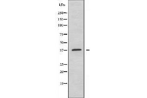 Western blot analysis of extracts from HepG2 cells using EFNA3 antibody. (Ephrin A3 anticorps  (C-Term))