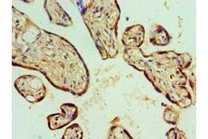 Immunohistochemistry of paraffin-embedded human placenta tissue using ABIN7143157 at dilution of 1:100 (ASCC3 anticorps  (AA 1-111))
