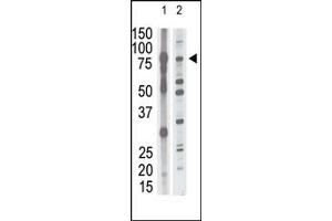 Western Blotting (WB) image for anti-Matrix Metallopeptidase 15 (Membrane-inserted) (MMP15) (N-Term) antibody (ABIN358688)